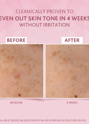 Cetaphil Brightening Day Protection Cream SPF 15-50 g| Day Cream for Dark Spots, Uneven Skin Tone| Niacinamide, Sea Daffodil| Fragrance-Free| 