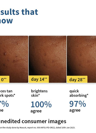 Plum 2% Niacinamide & Rice Water Sunscreen SPF 50 PA+++ | for Oily, Dry & Combination Skin | UVA/UVB Protection | Reduces Tan & Brightens Skin | No White Cast & Non-Sticky | for Women & Men | 15g 