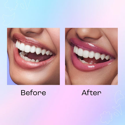 SUGAR Cosmetics Sugar Play Mega Hype Colour Changing Lip Oil | Ph Reactive Colour Changing Lip & Cheek Oil | Non-Sticky, Non-Greasy | 4.4Ml 