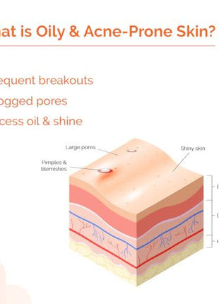 The Derma Co 1% Hyaluronic Sunscreen Oil-Free Gel SPF 50 PA++++ | For Oily, Acne-Prone Skin | Lightweight Texture | No White Cast | UVA/UVB, Broad Spectrum Protection & Blue Light Protection | Non- Comedogenic | Clinically Tested - (In -Vivo) | Tan Protec 